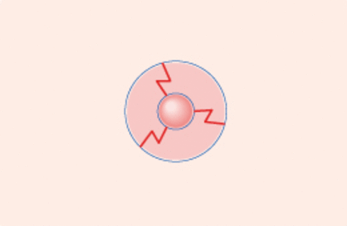 alt2