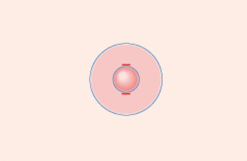 alt3